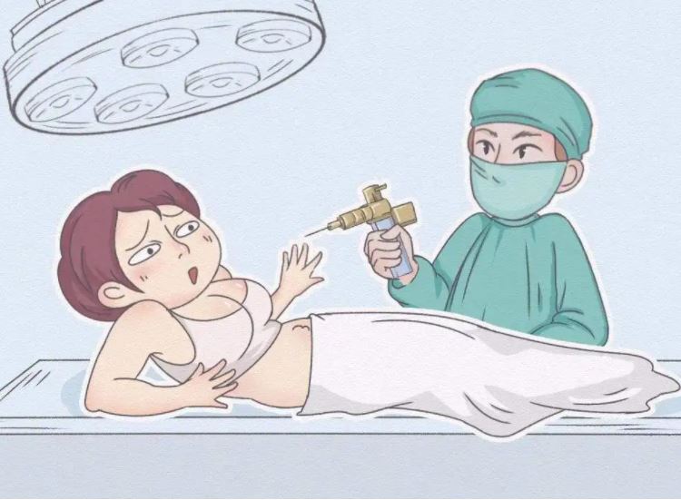 全身抽脂對(duì)身體有什么傷害？